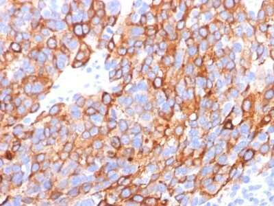 Immunohistochemistry-Paraffin: Melan-A/MART-1 Antibody (A103 + M2-7C10 + M2-9E3) - Azide and BSA Free [NBP2-34546]