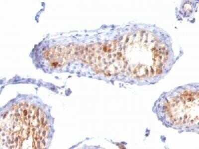 Immunohistochemistry-Paraffin: Melan-A/MART-1 Antibody (A103 + M2-7C10 + M2-9E3) - IHC-Prediluted [NBP2-44392]
