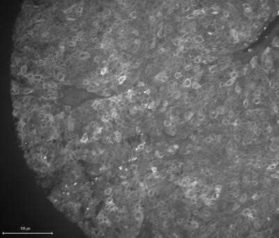 Immunohistochemistry-Paraffin: Melan-A/MART-1 Antibody (A103 + M2-7C10 + M2-9E3) - IHC-Prediluted [NBP2-44392]