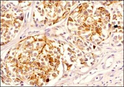 Immunohistochemistry: Melan-A/MART-1 Antibody (A103) - Azide and BSA Free [NBP2-80846]