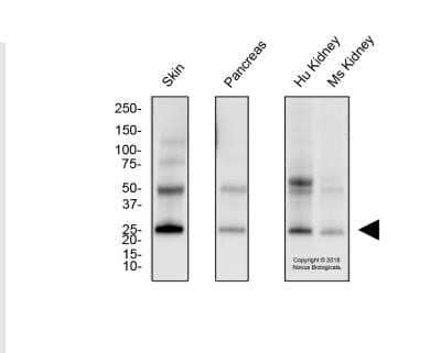 Western Blot: Melan-A/MART-1 Antibody (A103)Azide and BSA Free [NBP2-80846]