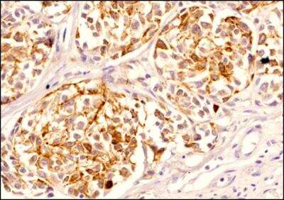 Immunohistochemistry-Paraffin: Melan-A/MART-1 Antibody (A103) - BSA Free [NBP2-46603]