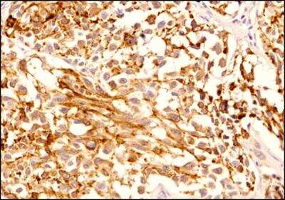 Immunohistochemistry-Paraffin: Melan-A/MART-1 Antibody (A103) - BSA Free [NBP2-46603]