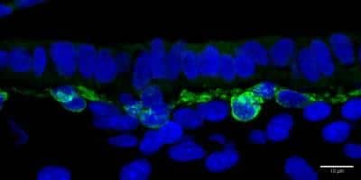 Immunohistochemistry-Paraffin: Melan-A/MART-1 Antibody (A19-P) [NBP1-30151]