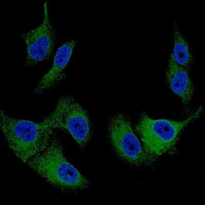 Immunocytochemistry/ Immunofluorescence: Melan-A/MART-1 Antibody (CL12863) [NBP3-18576]