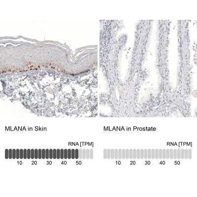 Immunohistochemistry-Paraffin: Melan-A/MART-1 Antibody (CL12863) [NBP3-18576]