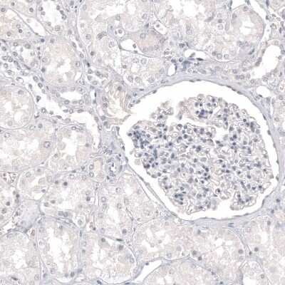 Immunohistochemistry-Paraffin: Melan-A/MART-1 Antibody (CL12863) [NBP3-18576]