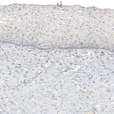 Immunohistochemistry-Paraffin: Melan-A/MART-1 Antibody (CL12863) [NBP3-18576]