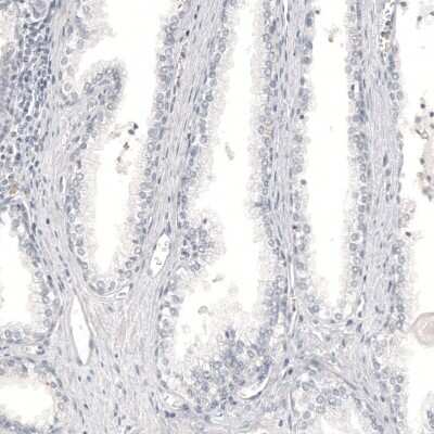 Immunohistochemistry-Paraffin: Melan-A/MART-1 Antibody (CL12863) [NBP3-18576]