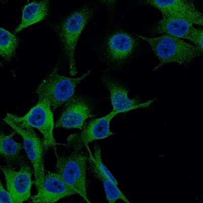 Immunocytochemistry/ Immunofluorescence: Melan-A/MART-1 Antibody (CL12864) [NBP3-18562]