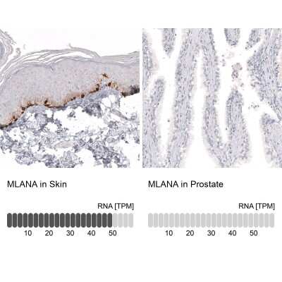 Immunohistochemistry-Paraffin: Melan-A/MART-1 Antibody (CL12864) [NBP3-18562]