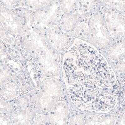 Immunohistochemistry-Paraffin: Melan-A/MART-1 Antibody (CL12864) [NBP3-18562]