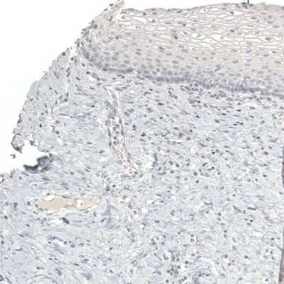 Immunohistochemistry-Paraffin: Melan-A/MART-1 Antibody (CL12864) [NBP3-18562]