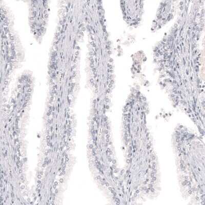 Immunohistochemistry-Paraffin: Melan-A/MART-1 Antibody (CL12864) [NBP3-18562]
