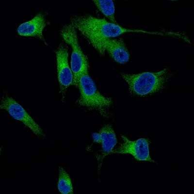 Immunocytochemistry/ Immunofluorescence: Melan-A/MART-1 Antibody (CL12874) [NBP3-18548]