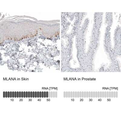 Immunohistochemistry-Paraffin: Melan-A/MART-1 Antibody (CL12874) [NBP3-18548]