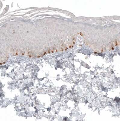 Immunohistochemistry-Paraffin: Melan-A/MART-1 Antibody (CL12874) [NBP3-18548]