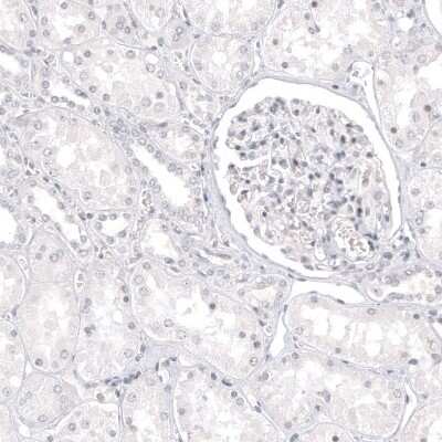 Immunohistochemistry-Paraffin: Melan-A/MART-1 Antibody (CL12874) [NBP3-18548]