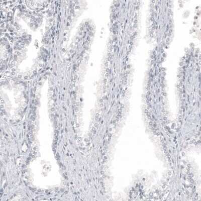 Immunohistochemistry-Paraffin: Melan-A/MART-1 Antibody (CL12874) [NBP3-18548]
