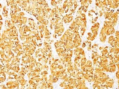 Immunohistochemistry-Paraffin: Melan-A/MART-1 Antibody (DT101 + BC199) - Azide and BSA Free [NBP2-34607]