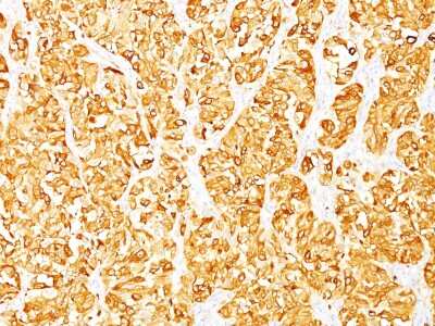 Immunohistochemistry-Paraffin: Melan-A/MART-1 Antibody (DT101 + BC199) [NBP2-34246]