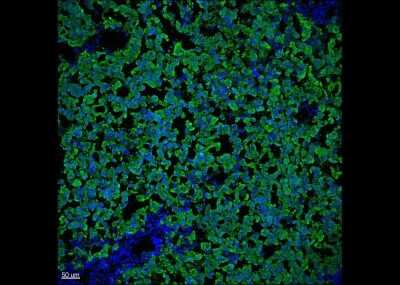 Immunohistochemistry-Paraffin: Melan-A/MART-1 Antibody (DT101 + BC199) [NBP2-34246]
