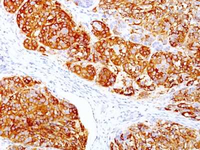 Immunohistochemistry-Paraffin: Melan-A/MART-1 Antibody (DT101 + BC199) [NBP2-34246]