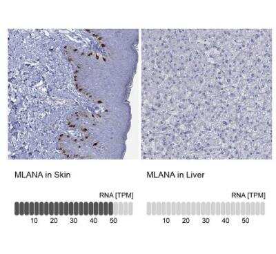 Immunohistochemistry-Paraffin: Melan-A/MART-1 Antibody [NBP2-33535]