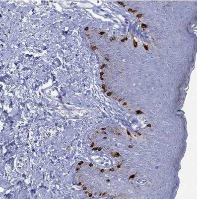 Immunohistochemistry-Paraffin: Melan-A/MART-1 Antibody [NBP2-33535]
