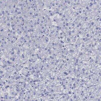 Immunohistochemistry-Paraffin: Melan-A/MART-1 Antibody [NBP2-33535]