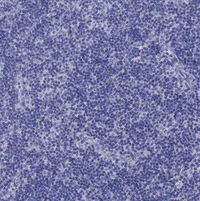 Immunohistochemistry-Paraffin: Melan-A/MART-1 Antibody [NBP2-33535]