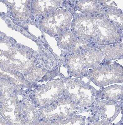 Immunohistochemistry-Paraffin: Melan-A/MART-1 Antibody [NBP2-33535]