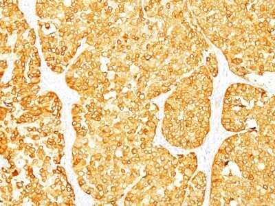 Immunohistochemistry-Paraffin: Melan-A/MART-1 Antibody (M2-7C10 + M2-9E3) - Azide and BSA Free [NBP2-34680]