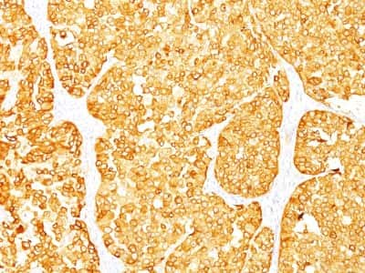 Immunohistochemistry-Paraffin: Melan-A/MART-1 Antibody (M2-7C10 + M2-9E3) [NBP2-34245]