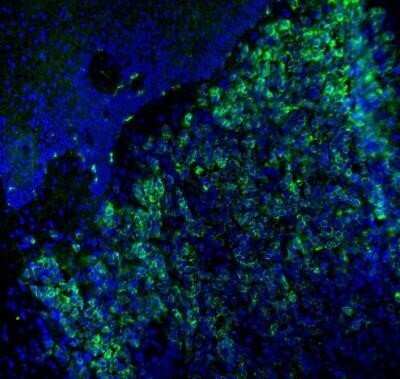 Immunohistochemistry-Frozen: Melan-A/MART-1 Antibody (M2-7C10) - Azide and BSA Free [NBP2-33148]