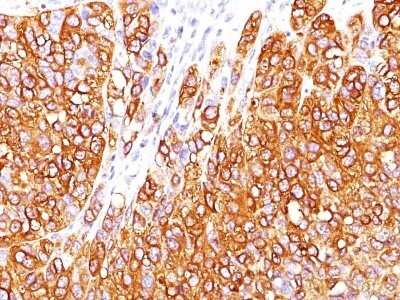 Immunohistochemistry-Paraffin: Melan-A/MART-1 Antibody (M2-7C10) - Azide and BSA Free [NBP2-33148]