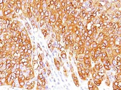 Immunohistochemistry-Paraffin: Melan-A/MART-1 Antibody (M2-7C10) - Azide and BSA Free [NBP2-33148]