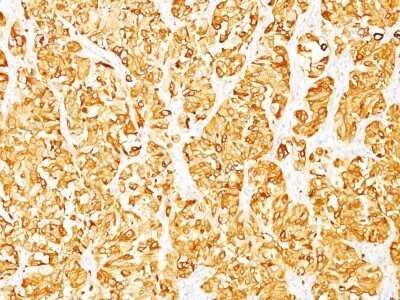 Immunohistochemistry-Paraffin: Melan-A/MART-1 Antibody (M2-7C10) - IHC-Prediluted [NBP2-44386]