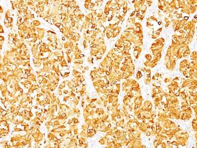 Immunohistochemistry-Paraffin: Melan-A/MART-1 Antibody (M2-7C10) [NBP2-15197]