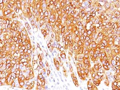 Immunohistochemistry-Paraffin: Melan-A/MART-1 Antibody (M2-7C10) [NBP2-15197]