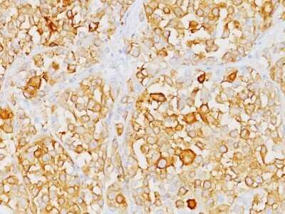 Immunohistochemistry-Paraffin: Melan-A/MART-1 Antibody (M2-9E3) - Azide and BSA Free [NBP2-33150]
