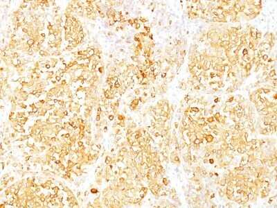 Immunohistochemistry-Paraffin: Melan-A/MART-1 Antibody (M2-9E3) - Azide and BSA Free [NBP2-33150]