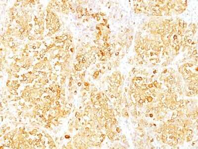 Immunohistochemistry-Paraffin: Melan-A/MART-1 Antibody (M2-9E3) - IHC-Prediluted [NBP2-44388]