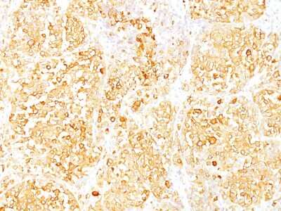 Immunohistochemistry-Paraffin: Melan-A/MART-1 Antibody (M2-9E3) [NBP2-15198]