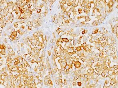 Immunohistochemistry-Paraffin: Melan-A/MART-1 Antibody (M2-9E3) [NBP2-15198]