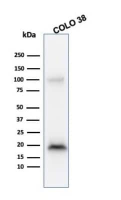 Western Blot: Melan-A/MART-1 Antibody (M2-9E3) [NBP2-15198]