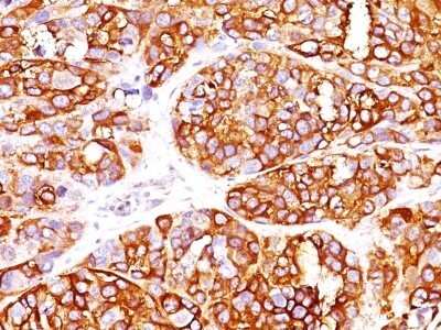 Immunohistochemistry-Paraffin: Melan-A/MART-1 Antibody (MLANA/1409R) - Azide and BSA Free [NBP2-54443]
