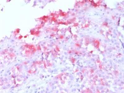 Immunohistochemistry-Paraffin: Melan-A/MART-1 Antibody (MLANA/1761R) - Azide and BSA Free [NBP2-54568]