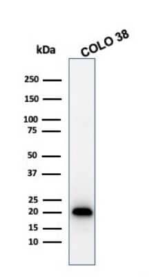 Western Blot: Melan-A/MART-1 Antibody (MLANA/1761R)Azide and BSA Free [NBP2-54568]