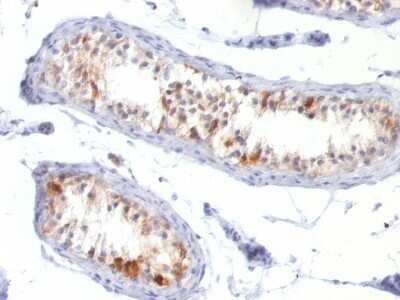 Immunohistochemistry-Paraffin: Melan-A/MART-1 Antibody (MLANA/788) - Azide and BSA Free [NBP2-47803]